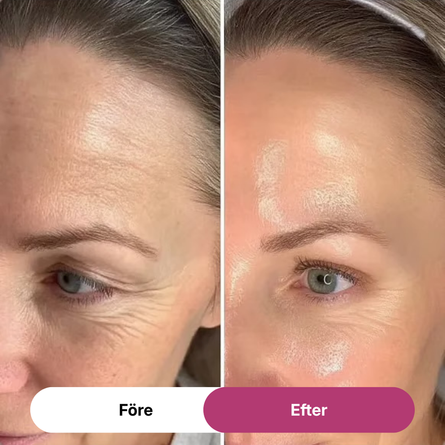 PDRN Collagen Volume Balm 2.0