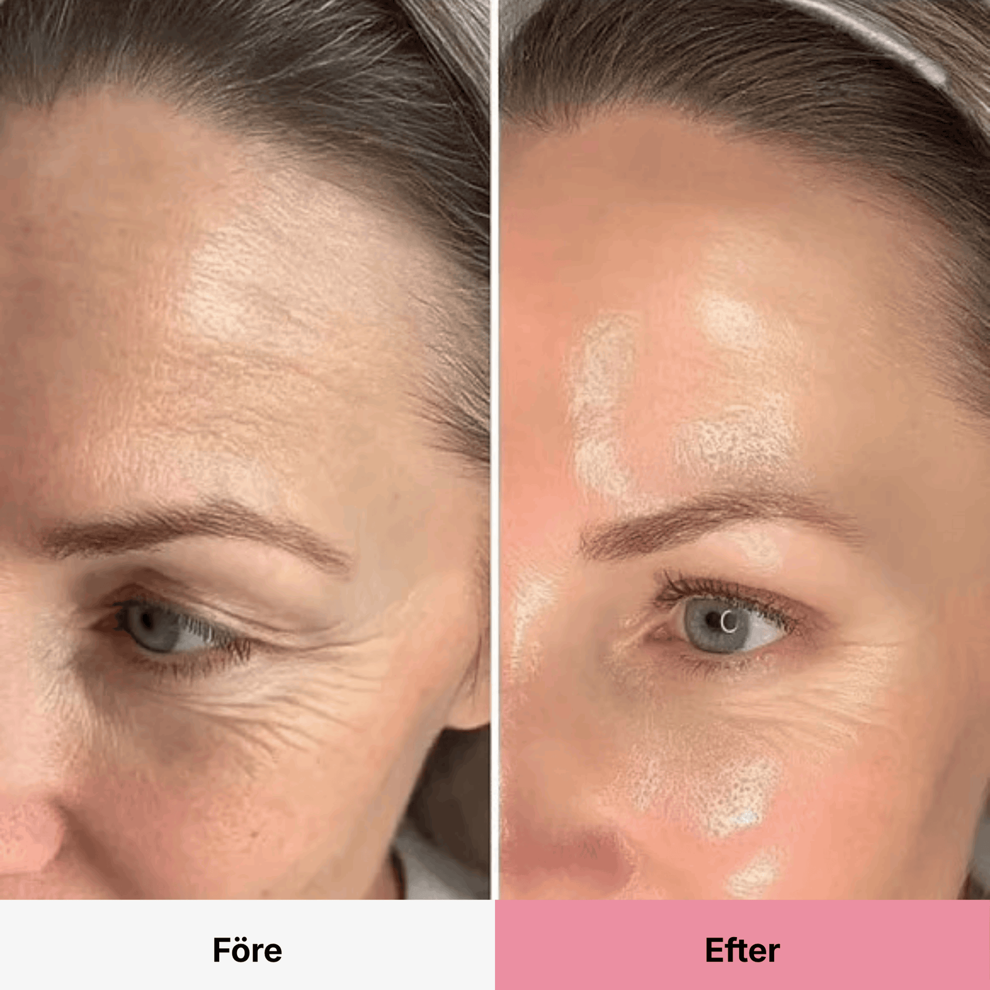 PDRN Collagen Volume Balm RITÚEL